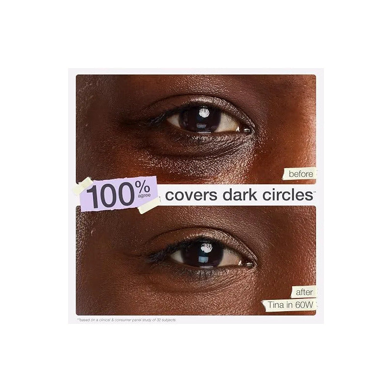 Tarte | Shape Tape Concealer | Corrector -10ml 57g-rich Golden