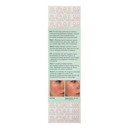 Innbeauty Project | Suero Para Rojeces - Calm The Red Down Sensible Día/noche