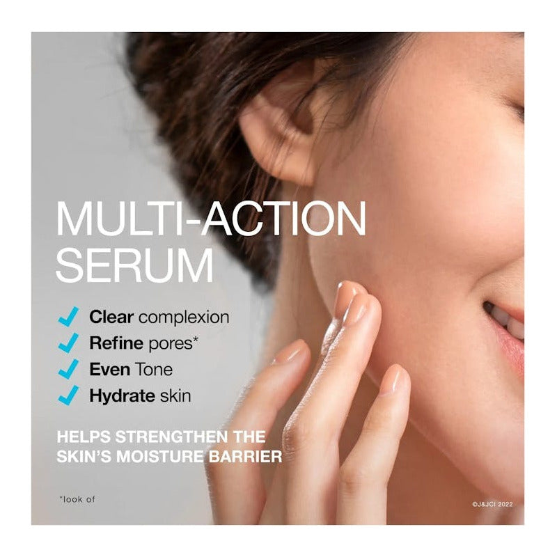 Neutrogena | Hydro Boost Niacinamide Serum - 29ml Todo Tipo De Piel Día/noche