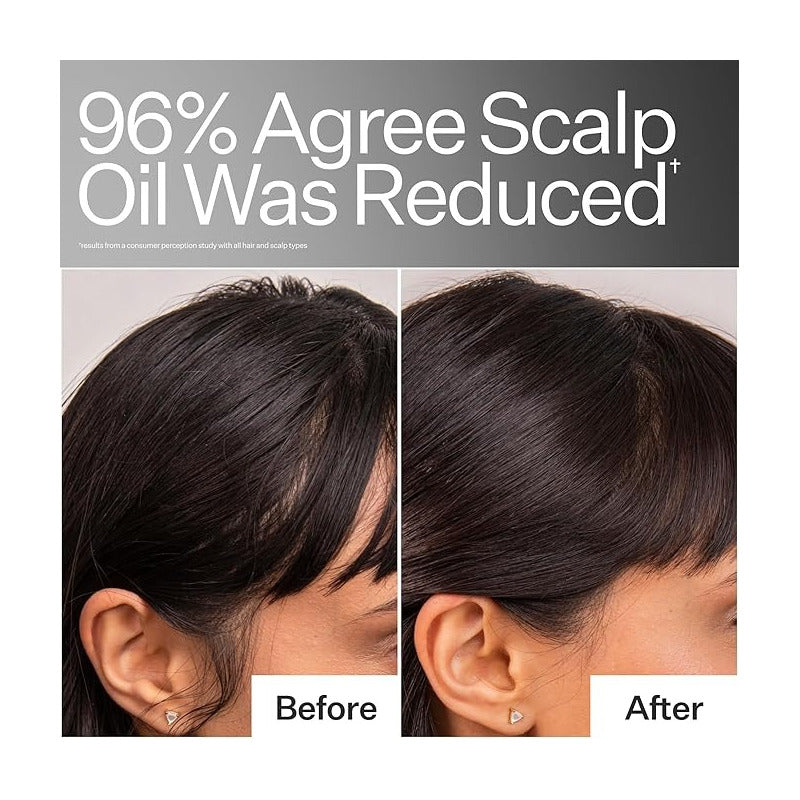 Act + Acre | Serum Cuero Cabelludo Graso | 4% Niacinamida