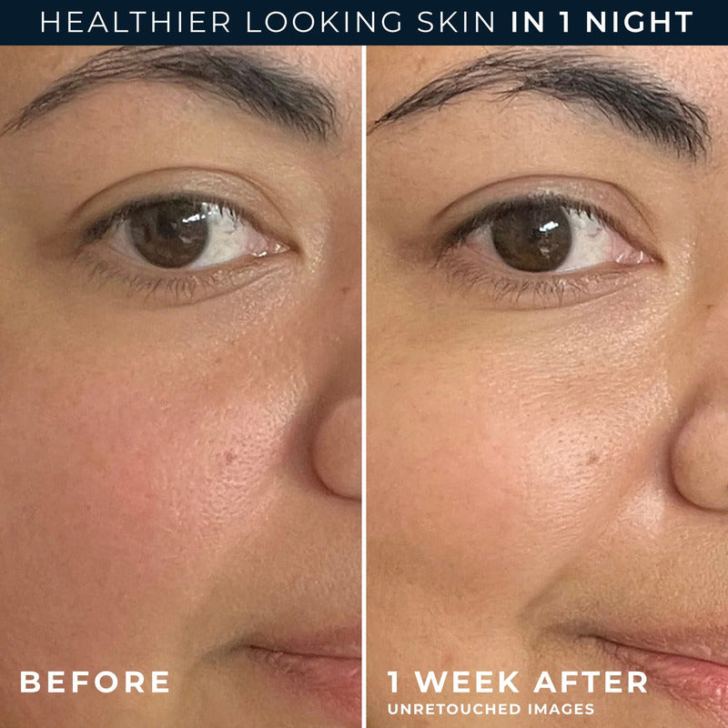 Roc | Derm Developed Barrier Renew Pm- Crema De Noche - 74ml Todo Tipo De Piel Noche