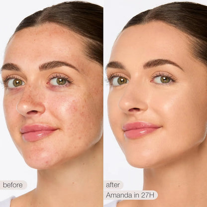 Tarte | Shape Tape Blur Concealer Stick | Corrector En Barra 27h Light Medium Honey