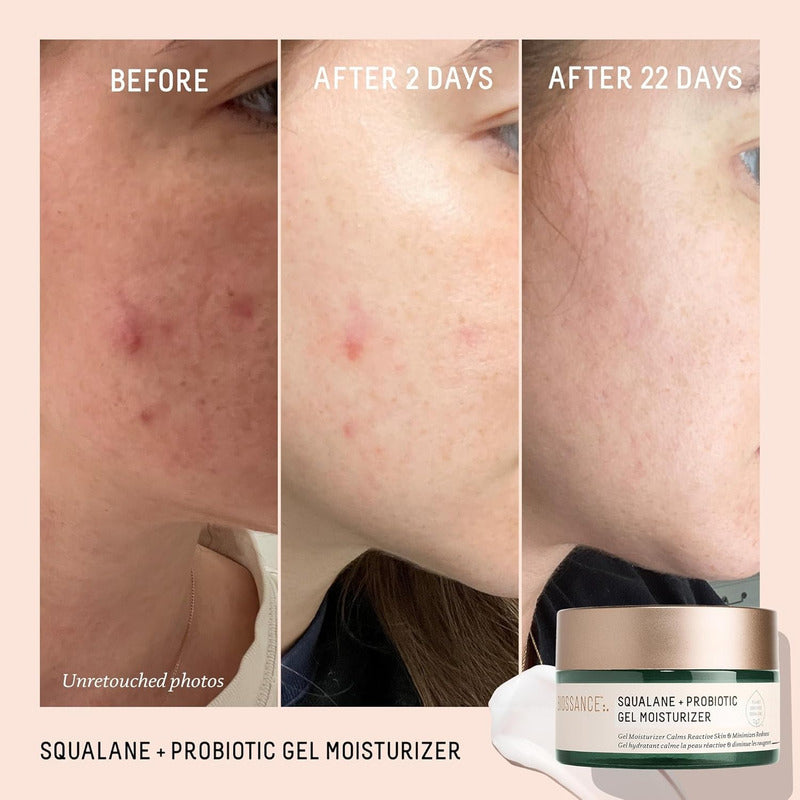 Biossance | Swualane + Probiotic Gel Moisturizer - 50ml