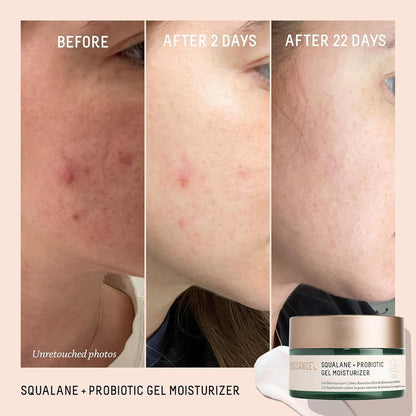 Biossance | Swualane + Probiotic Gel Moisturizer - 50ml